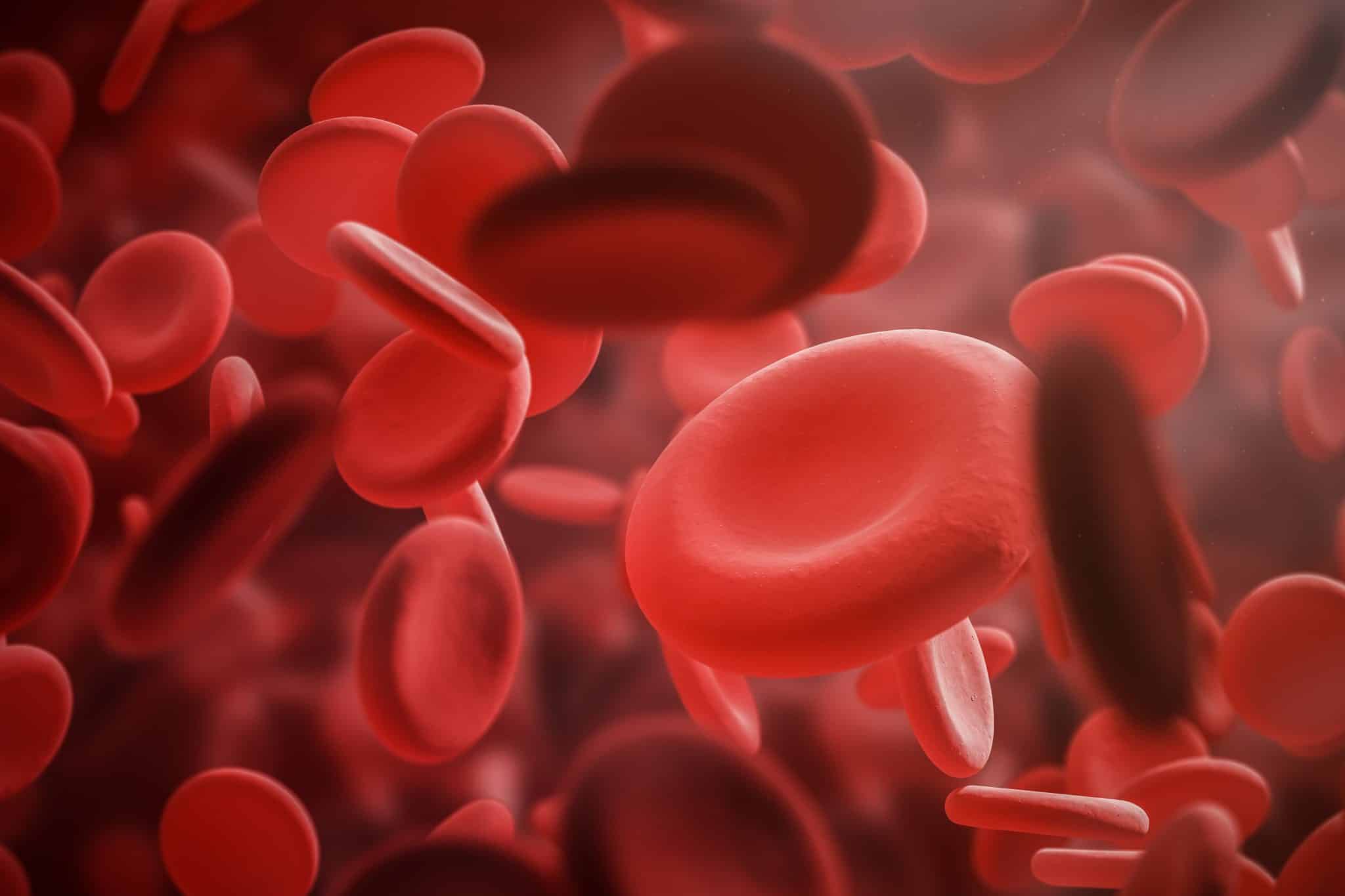 Iron Deficiency Anemia – How To Deal With It?