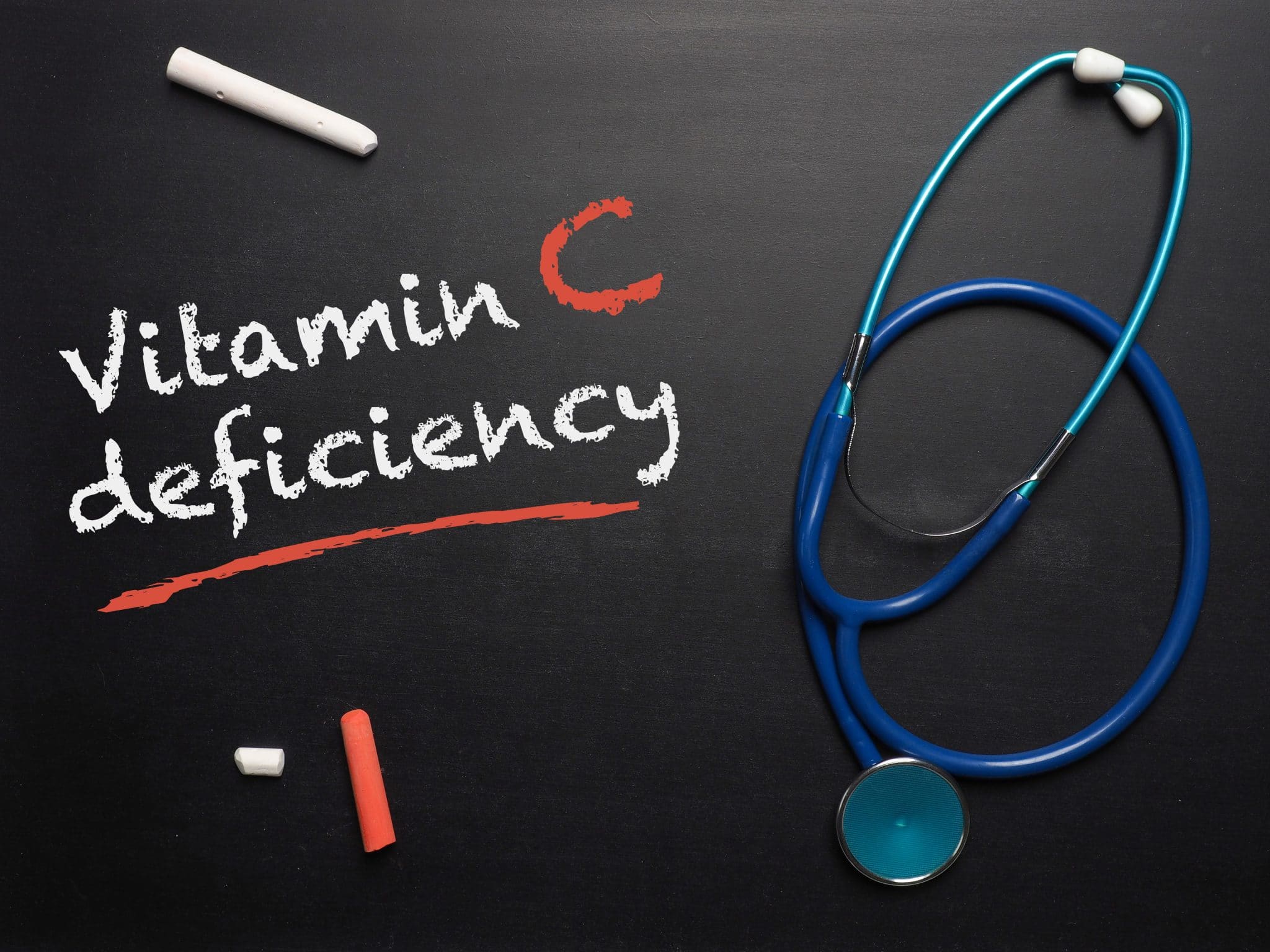 Vitamin C Deficiency – 15 Signs and Symptoms